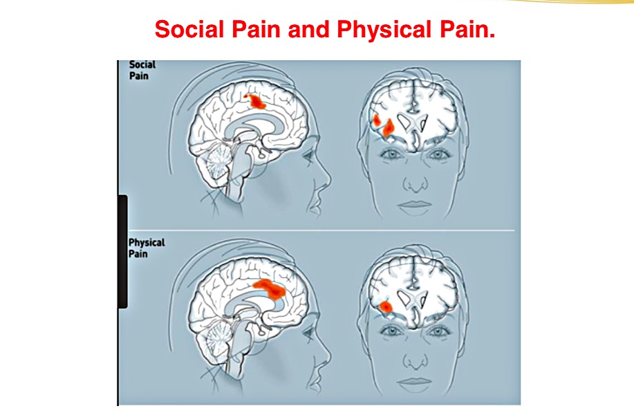 Social Pain